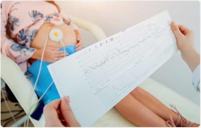 Pregnant woman undergoing electrocardiogram