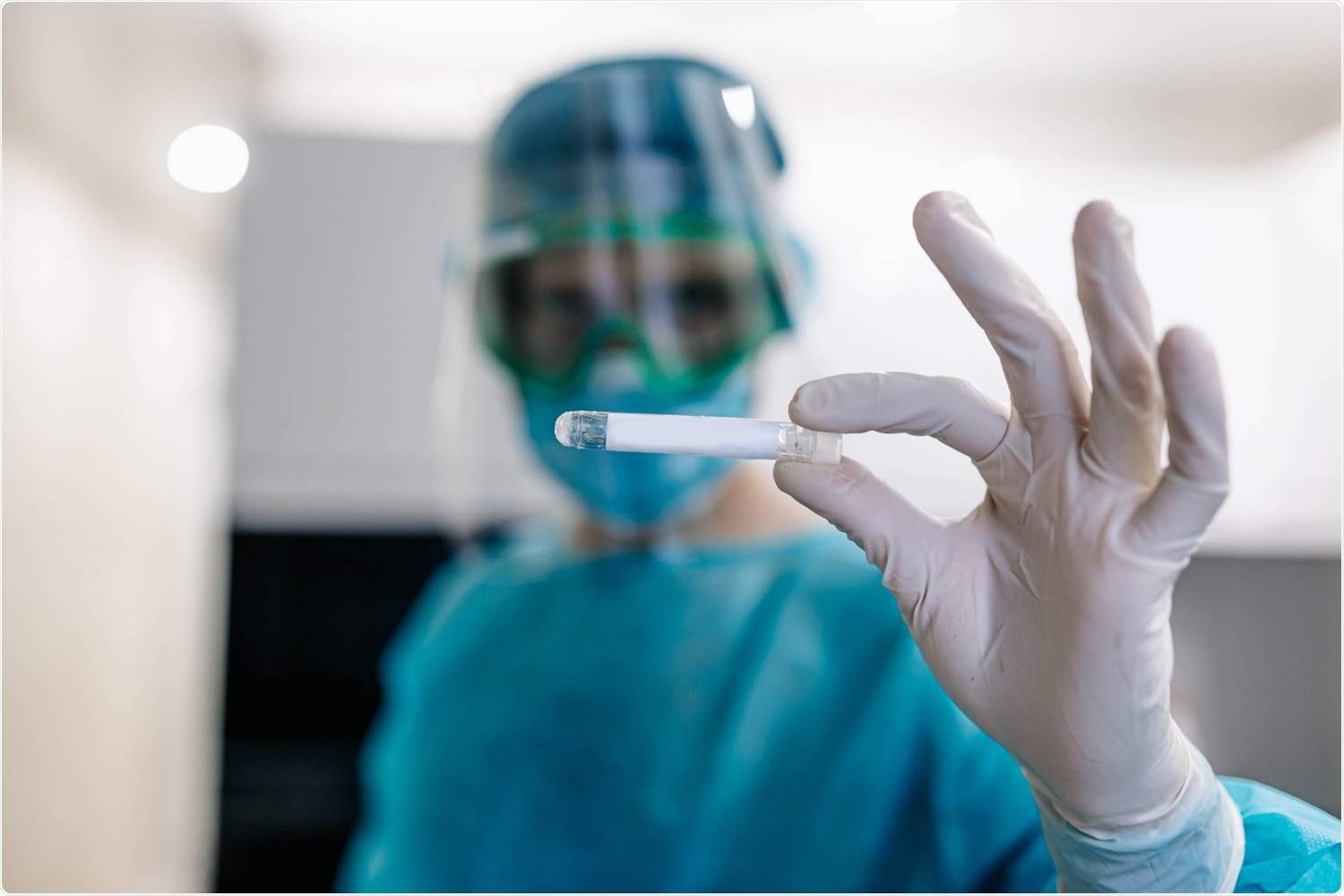 Study: The vaccinia-based Sementis Copenhagen Vector COVID-19 vaccine induces broad and durable cellular and humoral immune responses. Image Credit: Velimir Zeland / Shutterstock