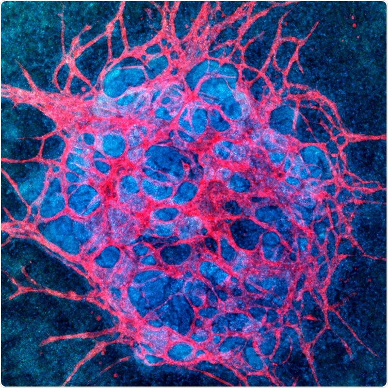 Harvard’s new kidney engineering technology licensed to San Diego-based Trestle Biotherapeutics