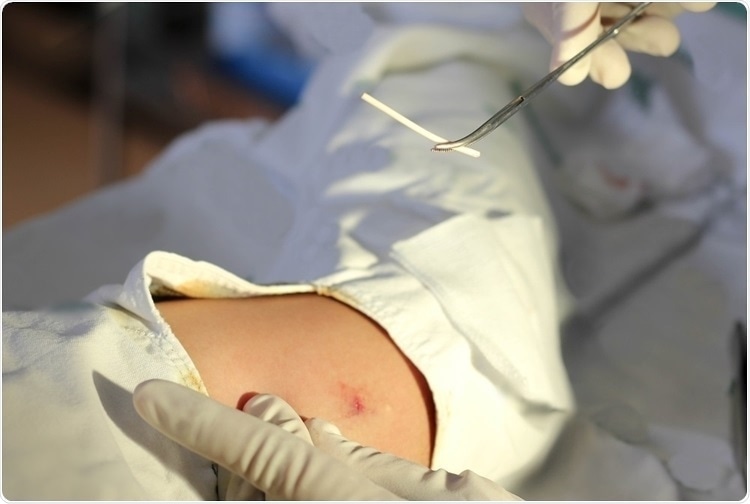 Insight into Sustained-Release Drug Delivery Systems Insight into Sustained-Release Drug Delivery Systems