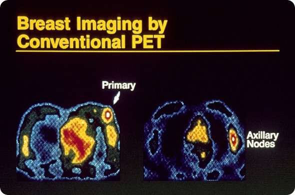 Breast imaging using pet