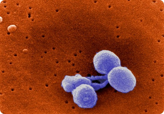 Scanning Electron Micrograph of Streptococcus pneumoniae