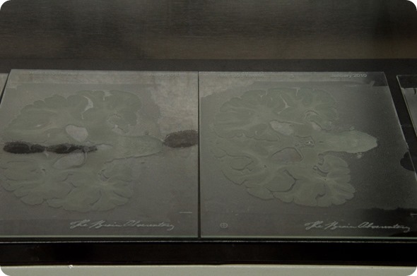 Tissue sections mounted on glass slides before staining