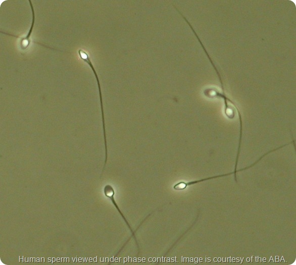 Linkam-image-of-sperm