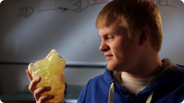 Heart tumor patient with 3D heart model