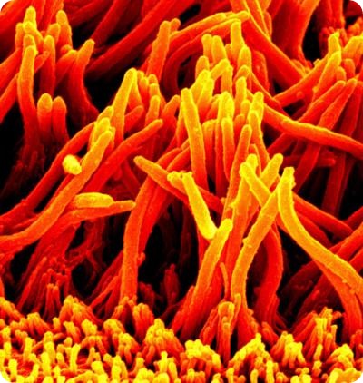 This is a scanning electron microscopy image of cilia from mouse airway epithelia culture. Credit: Thomas Moninger, University of Iowa