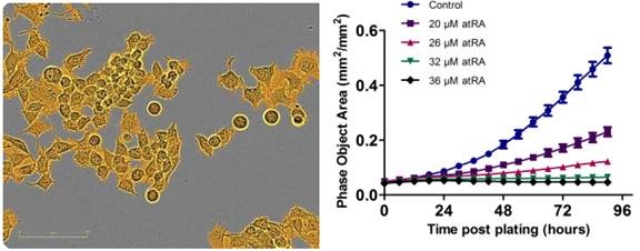Proliferation is successfully measured using an IncuCyte phase-only processing module