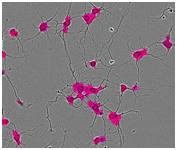 Segmentation masking of rat E18 cortical neurons