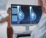 The Biochemistry of Breast Cancer Screening