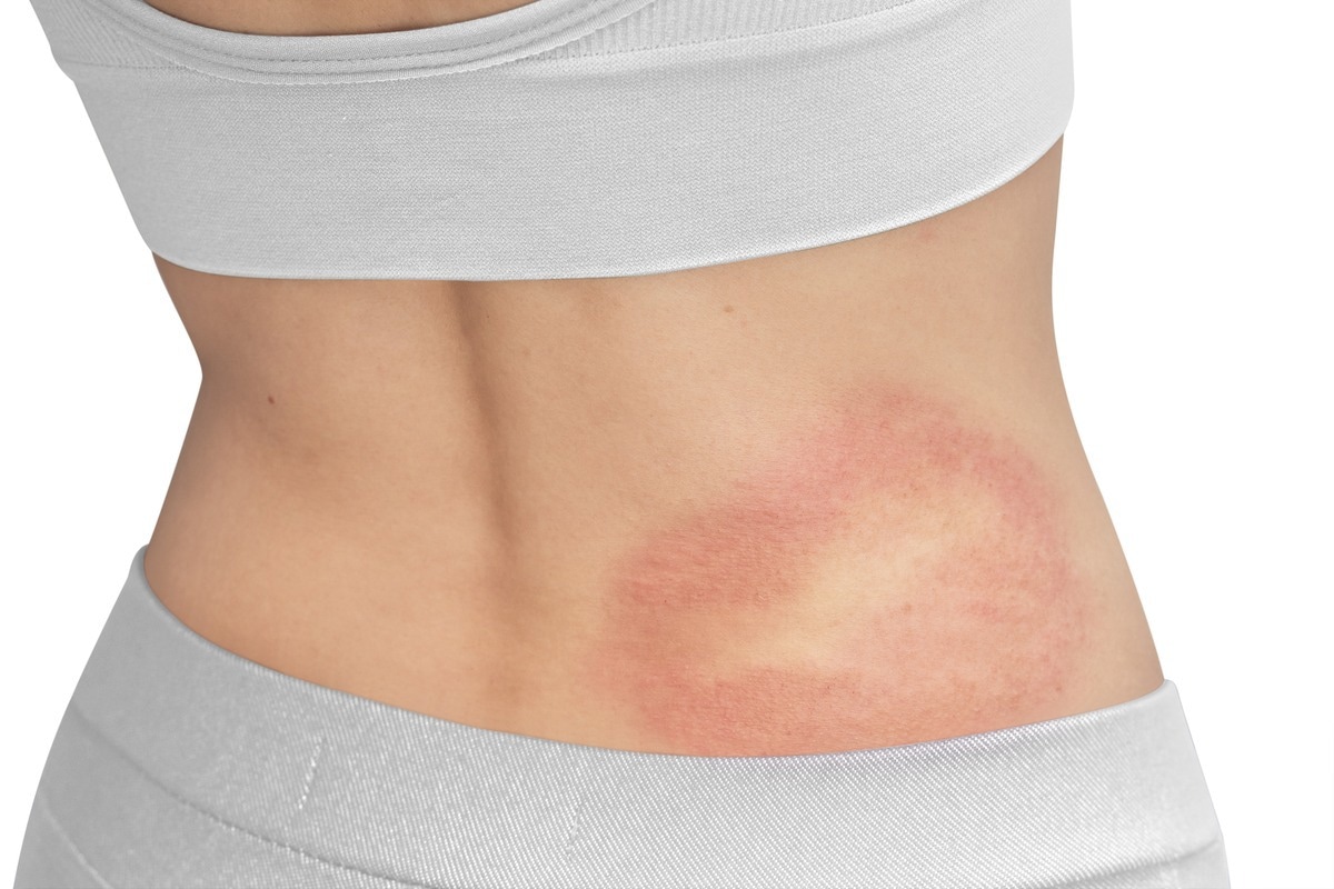 Image Credit: OHishiapply/Shutterstock