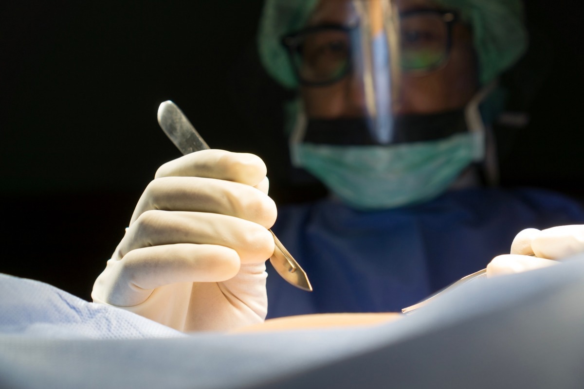 Surgical excision is a common treatment path. Image Credit: ThePink/Shutterstock