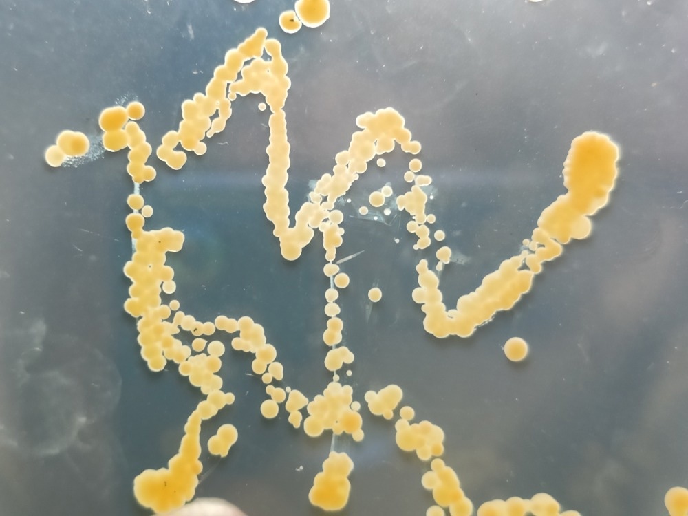 Staphylococcus aureus