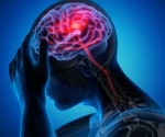 What are Arachnoid Cysts?