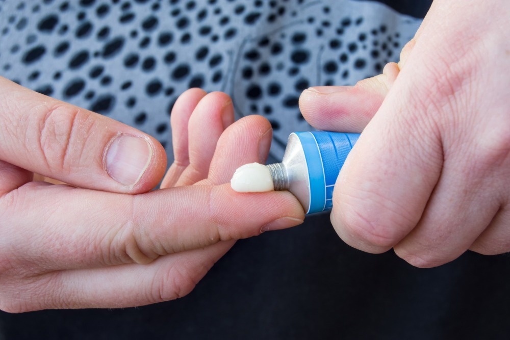 Close-up of a person applying cream from a blue tube onto their finger, highlighting the use of topical treatments for Pityriasis Rosea relief.