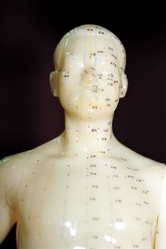 Acupuncture