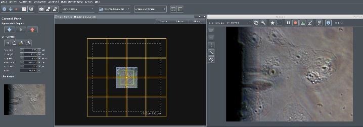 The role of molecular interactions in cell differentiation and cancer invasion