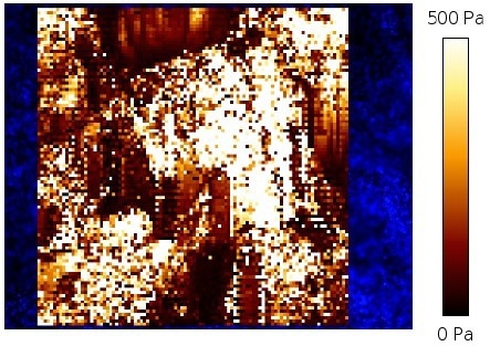 The role of molecular interactions in cell differentiation and cancer invasion