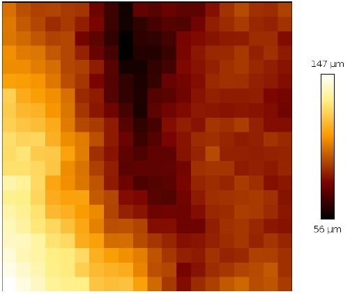 The role of molecular interactions in cell differentiation and cancer invasion