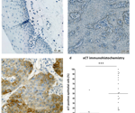Discovery of promising therapeutic approach for treating HNSCC tumorous cells via xCT inhibition using TissueFAXS whole-slide imaging