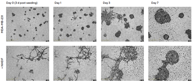 Introducing real-time live-cell analysis with The Incucyte® live-cell analysis system Temporal effects on morphology revealed through Incucyte® DF Brightfield imaging.
