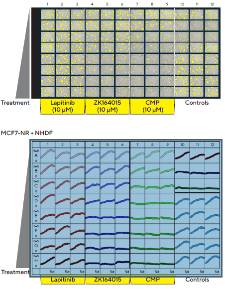 Introducing real-time live-cell analysis with The Incucyte® live-cell analysis system Incucyte® S3 vessel views enable rapid visualization and quantification of treatment effects. MCF7 cells co-cultured with NHDFs were seeded in pre-coated (Matrigel) flat bottom 96-well plates (1:1 ratio, 1,000 cells/well of each) and multi-spheroids allowed to form (3 d). Spheroids were then treated with serial dilutions of known standard of care and cytotoxic compounds (5 d). Incucyte® microplate vessel views show effects of treatments on multi-spheroid size. Top image shows Brightfield Object Area (μm2) segmentation mask (yellow) 5 d post treatment. Bottom image shows the individual well Total Brightfield Object Area (μm2) (y-axis) over time (0–5 d post treatment) (x-axis).