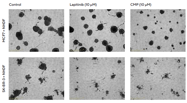 Introducing real-time live-cell analysis with The Incucyte® live-cell analysis system Interrogation of images to gain greater insight. MCF7 or SK-BR-3 cells co-cultured with NHDFs were seeded in pre-coated (Matrigel) flat bottom 96-well plates (1:1 ratio, 1,000 cells/well of each) and multi-spheroids allowed to form (3 d) prior to treatment with Lapatinib and Camptothecin (CMP). Incucyte® Brightfield images (5 d) show the effects of treatments on multi-spheroid size and integrity. Note: cytotoxic effects of CMP on both MCF7 and SK-BR-3 multi-spheroids and their difference in sensitivity to Lapatinib.