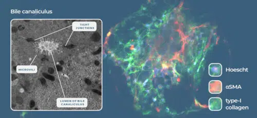 Liver-on-a-Chip models recreate the liver microarchitecture and can recapitulate the phenotype of metabolic diseases such as NASH