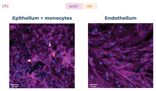 Addition of endothelial cells and monocytes allow mapping of disparate inflammatory responses. (A) Confocal images of the cell layers in the alveolar model, with epithelial and monocyte (Mθ) on the apical side (top) and endothelial cells on the basal side (bottom). Monocytes were stained with CellTracker™ Far Red (orange) and all cell stained with phalloidin (magenta) and DAPi (blue). Scale bar, 50 μm. (B) Bronchial cocultures with or without monocytes (Mθ) were challenged with LPS or poly(I:C) and IP-10 expression analysed using ELISA over 48 hrs. (C) Alveolar cocultures with or without monocytes (Mθ) were challenged with LPS or poly(I:C) and IP-10 expression analysed using ELISA over 48 hrs