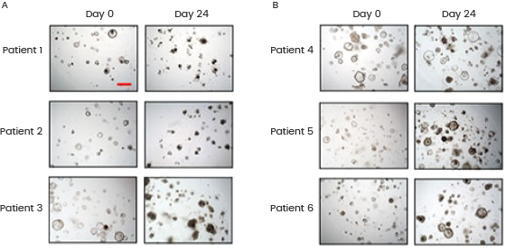 Representative bright-field images for colorectal cancer organoids on day 0 and day 24 in response to 5-Fu treatment. (A) 5-Fu sensitive organoids; (B) 5-Fu resistant organoids. Sino Biological proteins used in the organoid culture: RSPO1 (Cat#: 11083-HNAS), NOG (Cat#: 50688-M02H), EGF (Cat#: 50482-MNCH).