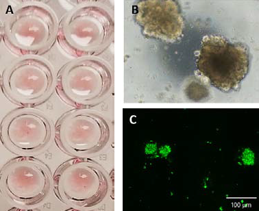 CRC PDOs seeded in Matrigel domes in a 96 well plate (A). PDOs after 7 days of culture (B) phase contrast image, and (C) calcein AM.