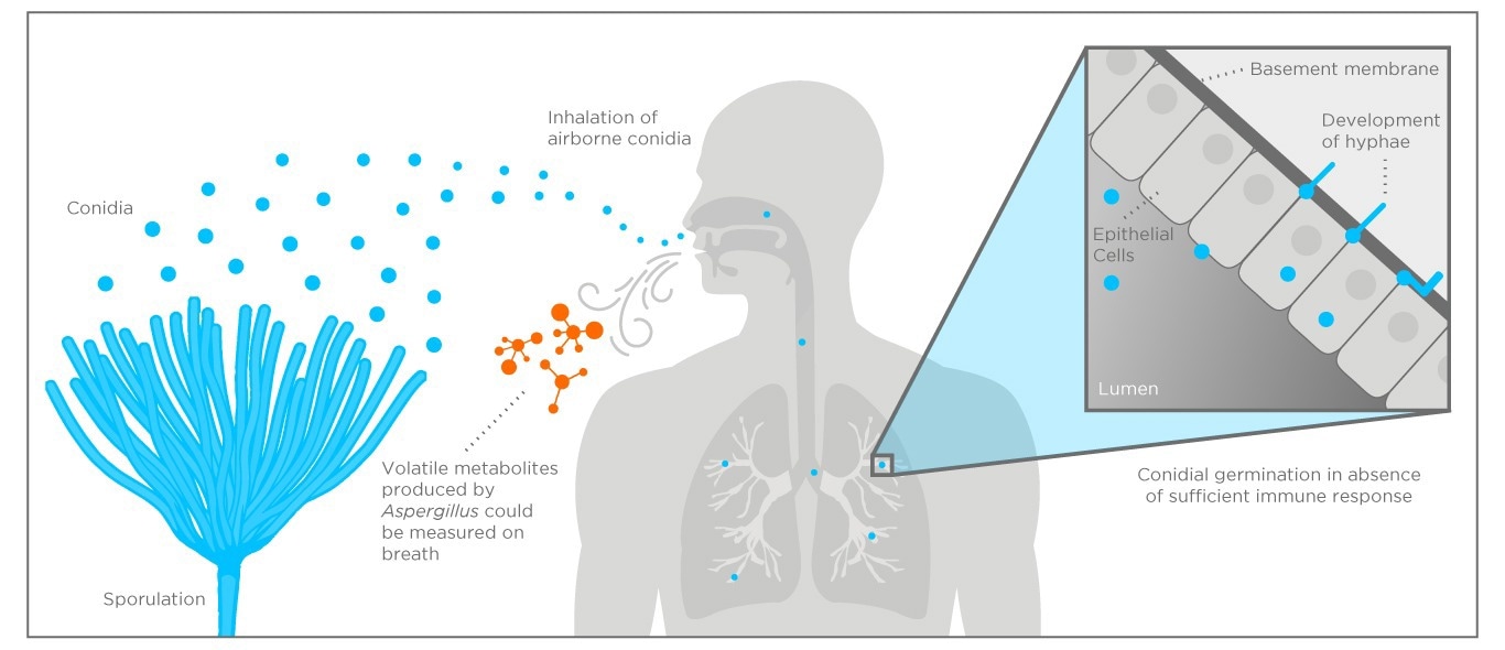 Conidia germinate in immunosuppressed patients leading to debilitating symptoms. Volatile secondary metabolite produced by Aspergillus can be detected on breath. Adaped from Dagenais et al (2009).