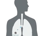 What disease areas can benefit from breath analysis?