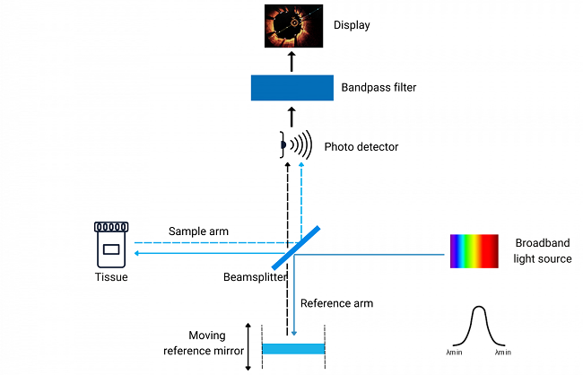 OCT system based on time-domain technology