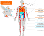 Can you develop volatile metabolites from exhaled breath into biomarkers?
