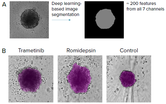 Automated image analysis of tumoroids was done using transmitted light images (label-free) (10X) with AI-based image analysis IN Carta software. A) SINAP (IN Carta) was used to develop a model to segment tumoroids. Over 200 features were then extracted from the segmentation mask from all 7 imaging channels (cell painting) that include stains for mitochondria, nuclei, ER, golgi, actin, RNAP and nucleoli. B) Examples of label-free images from tumoroids treated with different compounds and the corresponding segmentation mask (purple) from SINAP shown. Note that the SINAP model can identify tumoroids that are phenotypically different.