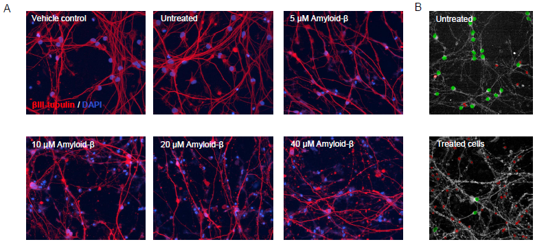 Exposure of ioGlutamatergic neurons to β-amyloid aggregates impaired neurite structure and the number of healthy nuclei. (A) Representative images of ioGlutamatergic neurons exposed for 72 hours to different concentrations (0-40 μM) of β-amyloid aggregates and stained for βIII-tubulin (red) and DAPI (blue). (B) Examples of nuclei segmentation in ioGlutamatergic neurons not treated or treated with β-amyloid aggregates. Green dots: healthy nuclei; red dots: unhealthy, condensed nuclei. High content imaging was performed using the Yokogawa CV8000.
