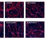 Could amyloid-beta hold the key to in vitro Alzheimer's models?