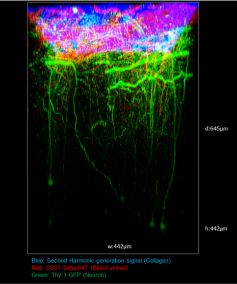 Two-Photon Brain Imaging in CIW-Implanted Thy1-M-GFP Mice
