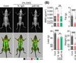 Assessing colitis treatment and body composition with IL-12/23 antibody and DEXA