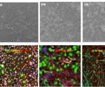 How to create an iPSC-derived in vitro model to study neuroinflammation