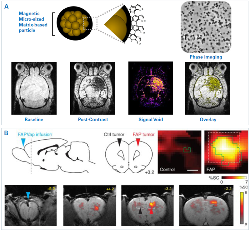 Examples of molecular MRI. A) Immuno-MRI with microsized matrix-based magnetic particles (M3P). Top: Representation of the structure and surface of MP3 and phase contrast microscopy. Bottom: T2*-weighted images of a mouse brain are depicted at baseline and 10 minutes after injection of M3P conjugated with monoclonal antibodies against VCAM-1. The mouse had been injected with lipopolysaccharide into the right striatum 24 h prior MRI. The resulting signal void and overlay are also shown. B) Hemodynamic molecular MRI of tumor-associated enzyme activity. Top left: An FAP-activatable probe was infused into the subarachnoid space caudal to the olfactory bulb and rostral to the tumors (blue arrowhead). FAP-expressing (red arrowhead) and control (black arrowhead) tumors were inoculated into the dorsal cortex (dashed line) in rats. Bottom: T2*-weighted MRI reveal signal change (color) following FAP-sensitive vasoprobe infusion in the presence of control (black arrowhead) and FAP-expressing (red arrowhead) xenografts overlayed on an anatomical image. Scale bar = 4 mm. Top right: Zoom-ins on tumor regions (dotted boxes). Scale bar = 0.5 mm