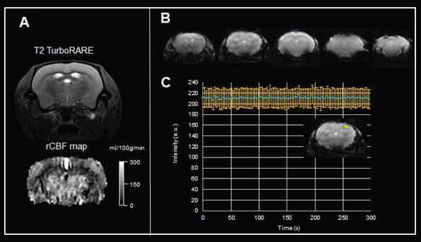Functional MRI of the brain. A) Pulsed arterial spin labeling of the mouse brain. Shown are a T2-weighted TurboRARE image for anatomical reference, and the rCBF map computed from the flow-sensitive alternating inversion recovery (FAIR)-EPI method. Data were acquired with a BioSpec Maxwell 94/17 using a linearly polarized bird-cage resonator for transmission and a phased-array receive-only surface coil in cross-coil mode under isoflurane anesthesia. B) Example of gradient echo EPI images of the mouse brain acquired with a BioSpec Maxwell 94/17 equipped with a 23 mm volume coil. Shown are five 0.6 mm thick axial slices with an in-plane resolution of 141 μm x 156 μm. C) The time course characteristics of EPI imaging for fMRI studies were assessed by acquiring 100 repetitions of gradient echo EPI over an acquisition time of 5 minutes with active drift compensation. Acquisition shows solid time course stability with a temporal signal-to-noise ratio = 123