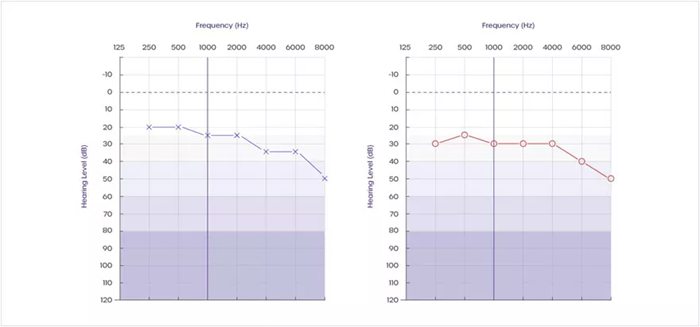 Exploring the purpose of the Békésy test