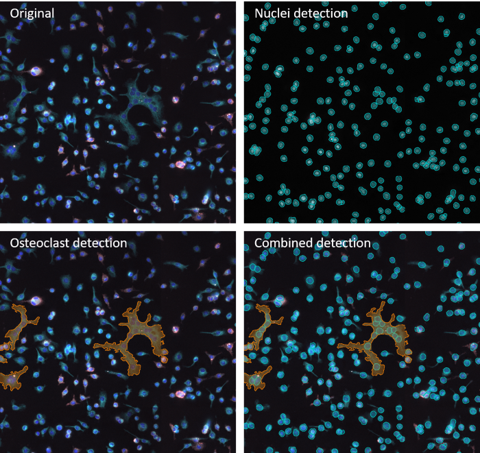 Example of image anaylsis performed by IF Cell Culture - Osteoclast App