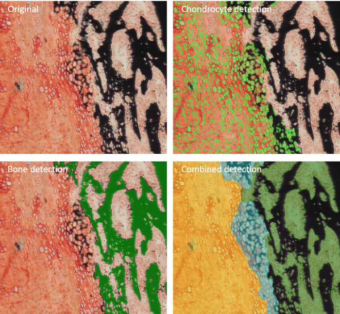 Example of image anaylsis performed by Bone Mineralization App
