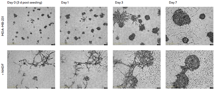 Temporal effects on morphology revealed through Incucyte® DF Brightfield imaging. MDA-MB-231 cells were seeded in flat bottom 96-well plates on a bed of Matrigel in mono- or co-culture with NHDFs (1:1 ratio, 1,000 cells/well for each) and multi-spheroids allowed to form (3 d). Incucyte® S3 DF Brightfield images compare mono- and co-culture conditions over 7 d (10 d post cell seeding). Note the temporal impact of NHDFs on spheroid morphology