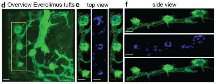 Light-sheet fluorescence microscopy shows 3D tuft morphology. mTOR inhibition with Everolimus leads to highly active filopodia and cup morphology in vascular tufts. Figure 6 - figure supplement 3 reproduced under CC BY 4.0 DEED license.