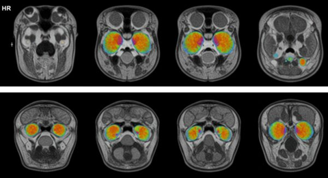 GaGe digitizers power high-resolution imaging in ultrasound and diagnostics