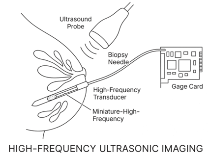 Breakthrough imaging for early ovarian cancer detection with GaGe digitizers
