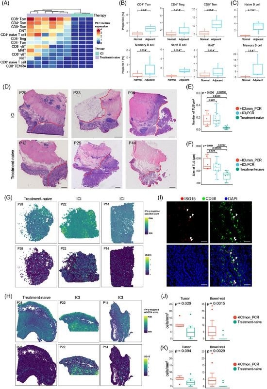 Immune profiling of the macroenvironment in colorectal cancer (CRC) patients with immune checkpoint inhibitor (ICI) treatment